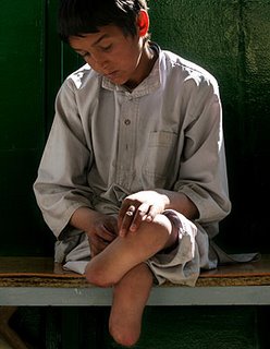 Un niño afgano que ha perdido sus dos piernas por culpa de las minas antipersonas