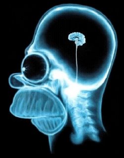 Exame do cránio do José Serra, no centro, um tumor pequeno ou o seu próprio cérebro, a biópixia revelará!
