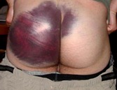 Got My Ass Spanked