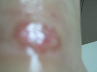 right foot :)