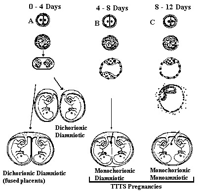 The different ways an embryo may split to make identical, like sexed babies, depending on how many days after conception