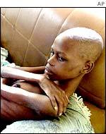 BBC Photo: South African AIDS victim