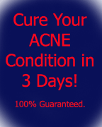Natural Acne Skin Care img2