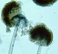Rhyzopus oryzae, hongo que puede desarrolarse en la piel de humanos