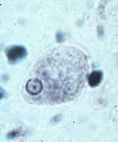 E.histolytica,causante de disentería amebiana