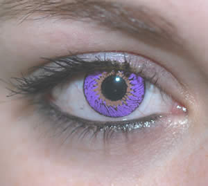 What is purple eye disease?