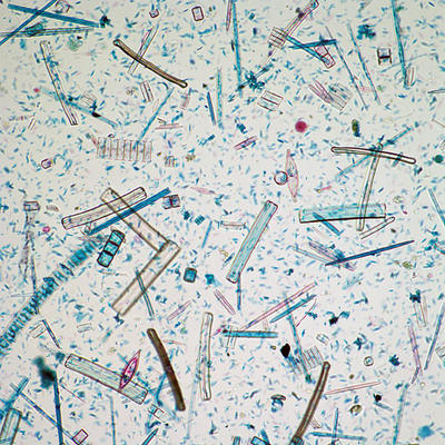 diatoms image