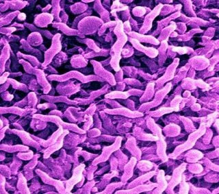 Resultado de imagen para Campylobacter spp