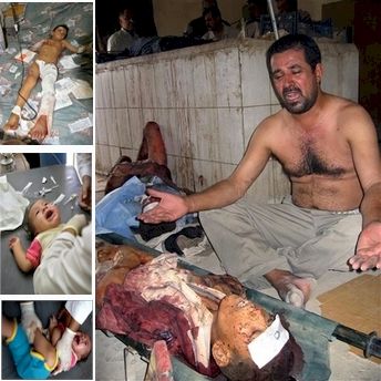 Composite graphic showing dead and wounded children