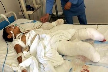 11 YO Muhamed Sameer Moussa was wounded in an Israeli air strike his legs had to be amputated