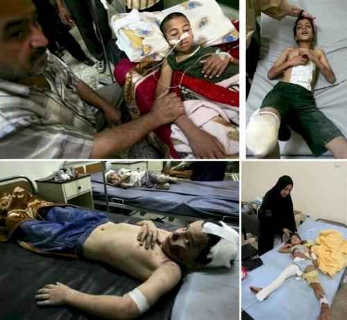 Children injured in the rocket attacks from Dora on Zaafaraniyah being treated in hospital