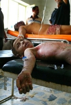 This boy shown in Baqouba hospital was injured by a mortar attack August 22nd 2006