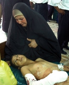 Boy injured by bombing in Dora targetting Iraqi interior minister photographed in hospital being comforted by his mother