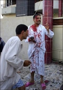 A man injured in the attack on the Turkmen Front Party Office in Kirkuk gestures for help