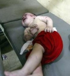 The baby in this photograph was wounded in yesterday's rocket attacks on al-Amin