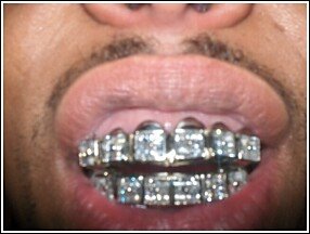 Image result for gangsta grillz teeth