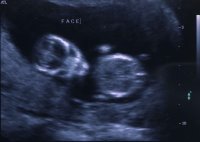 New Baby Euphrony at 12-1/2 weeks