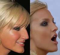 Ashlee Simpson, before and after.