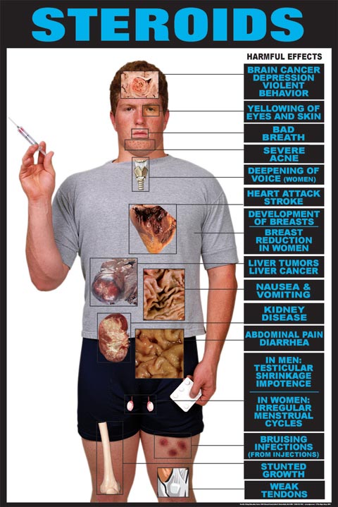 consequences of steroids in sports essay consequences of steroids in sports essay