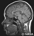 Brain MRI Scan Amsterdam University Unconscious Mind (Evolution Research: John Latter / Jorolat)