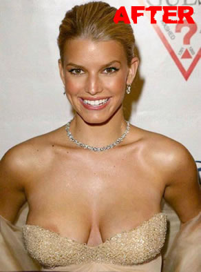 Jessica Simpson after plastic surgery