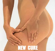 New Cure for Cellulite