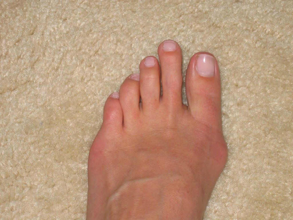 Yoga Toes Beauty On A Budget