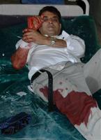 bahrain's top envoy in iraq, hassan malallah al-ansari, lies wounded in a baghdad hospital tuesday, july 5, 2005. ap photo by asaad muhsin