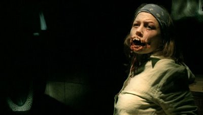 Didn't your Dentist warn you about gum disease?