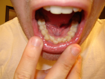 teeth bottom perfect each straight right again damn trying using move messed