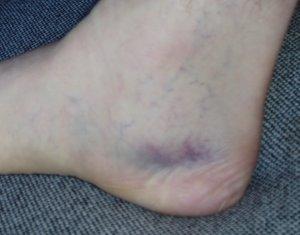 Inside of foot