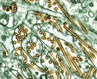 Colorized transmission electron micrograph of Avian influenza A H5N1 viruses (seen in gold) grown in MDCK cells (seen in green).