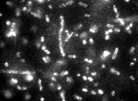 This fluorescence micrograph shows phage-quantum dot complexes (bright spots) bound to E. coli cells (cylindrical shapes). The NCI/NIST method of tagging cells with quantum dots can be used to identify bacteria much faster than conventional methods. The fluorescence signal is strong and stable for hours, enabling scientists to count the number of phage viruses bound to a cell. Credit: NCI/NIST, Usage Restrictions: None.