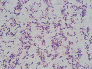 Helicobacter gram's stain