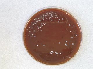 contaminated agar