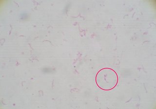 urea plate-single colony1