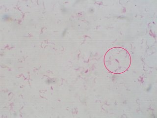 urea plate-single colony2