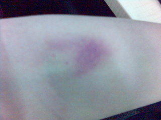 3day after