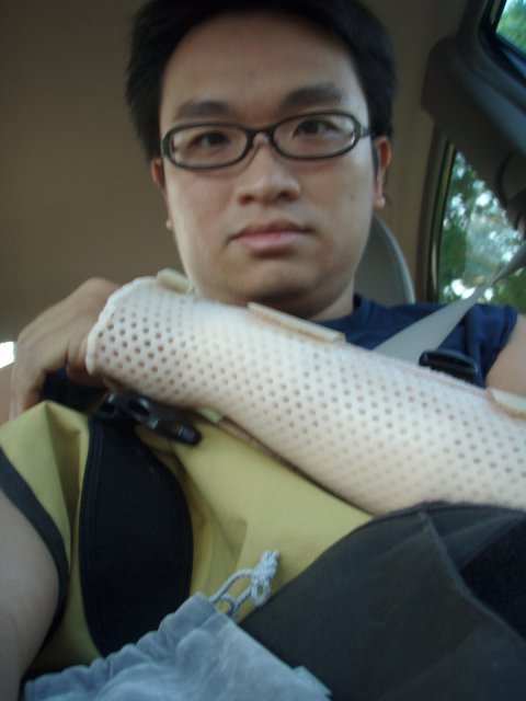My Arm Cast