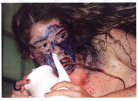 bulimia