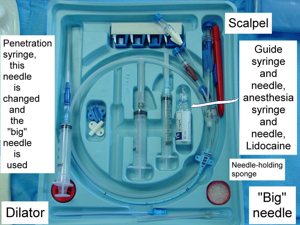 Clinical Notes: Central Line Placement: A Step-by-Step Procedure Guide with  Photos