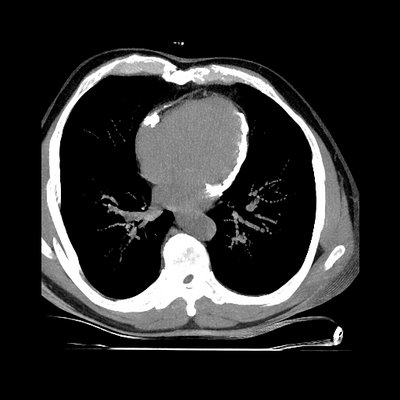 Heart scan curiosities: Heart scan curiosities 1