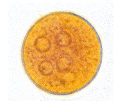Quiste de Entamoeba coli
