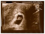 First U/S pic of Baby #1