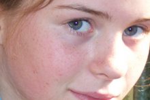 Aoife Rooney