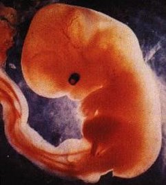 abortion and the christian view on eliminating life in the womb There are many complexities in the discussion of the abortion issue: complexities about care for mothers, care for children, preventative care, abstinence, women’s rights, and the origins of life in the womb. abortion and the christian view on eliminating life in the womb There are many complexities in the discussion of the abortion issue: complexities about care for mothers, care for children, preventative care, abstinence, women’s rights, and the origins of life in the womb.