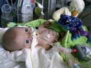 Matthew after his first open heart surgery