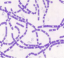 Bacillus anthracis, bacteria cusante del Antrax