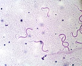 Treponema pallidum, espiroqueta causante de la Sífilis