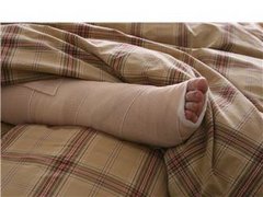 Broken Ankle 2007
